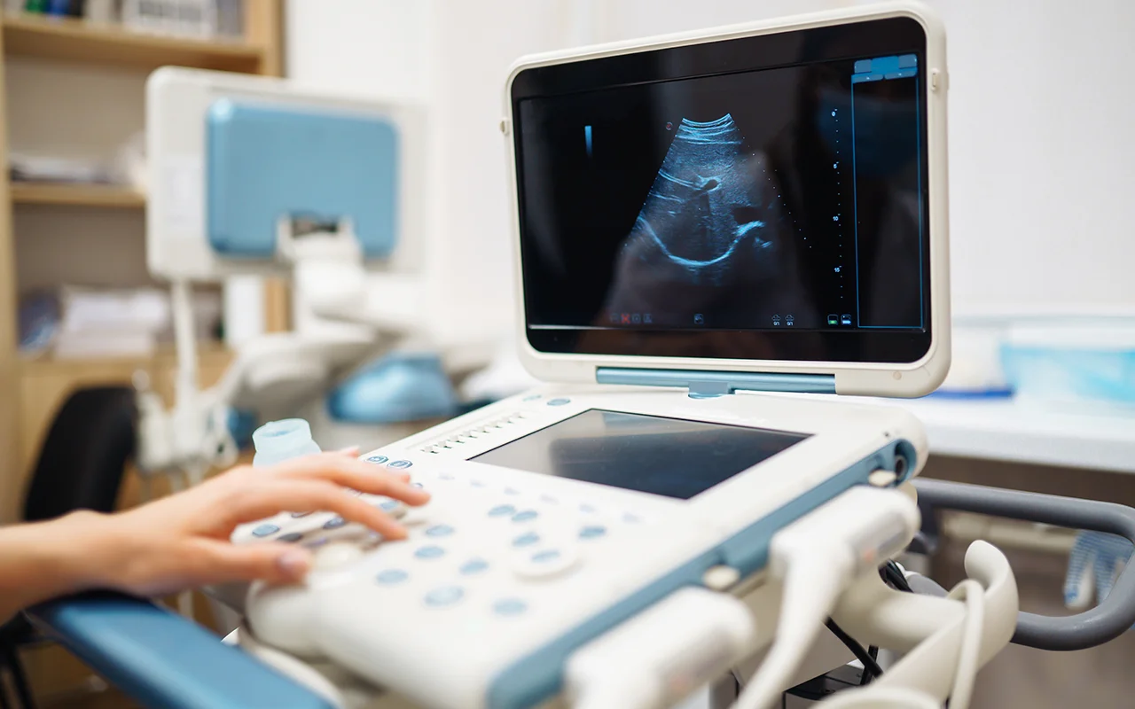 Ultrasonography Image